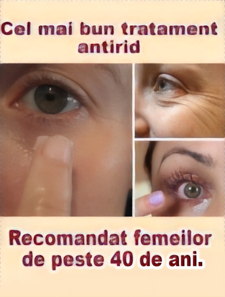 Recomandat femeilor de peste 40 de ani. Este eficient, absolut natural si e mai ieftin decat orice crema antirid